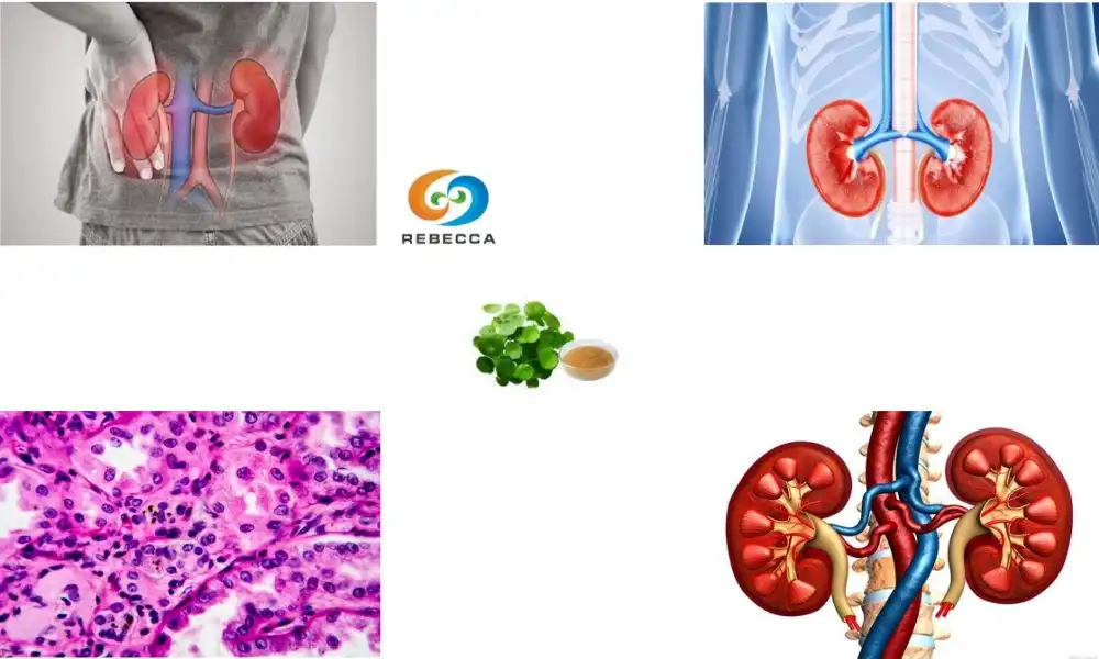 Is Gotu Kola Powder Good for Kidneys?